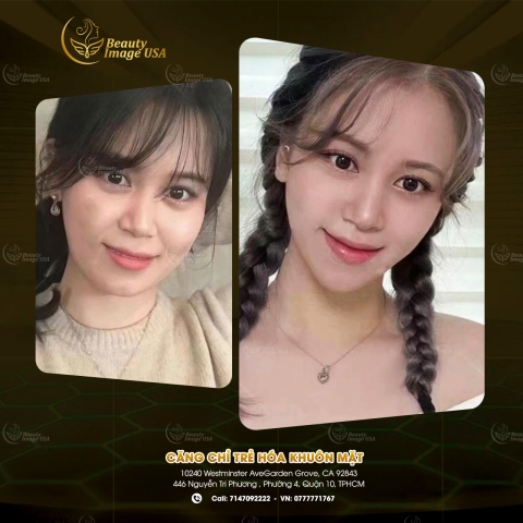 Album căng chỉ