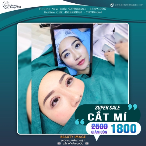 Hình Ảnh Cắt Mí