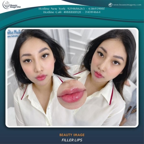 Album căng chỉ