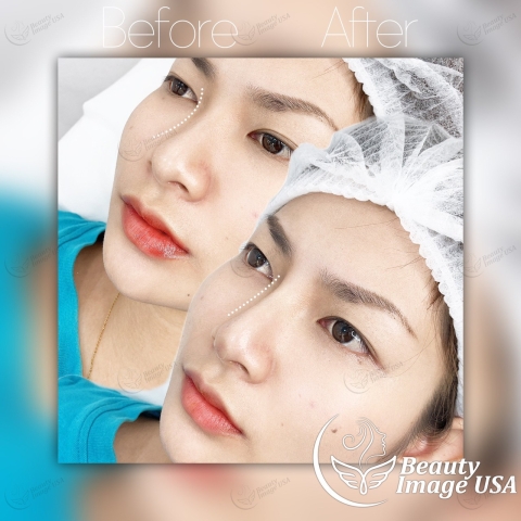 Album căng chỉ