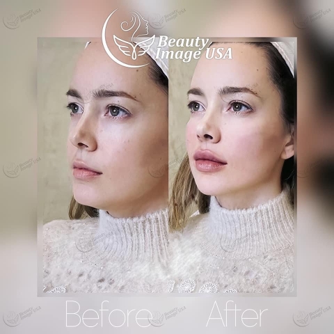 Album căng chỉ