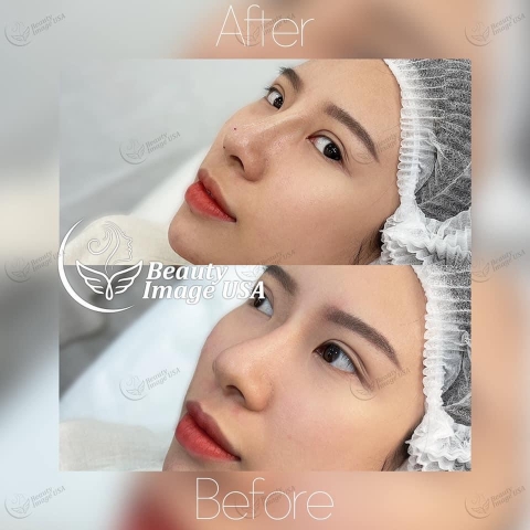 Album căng chỉ