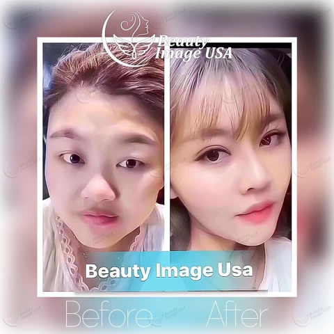 Album căng chỉ