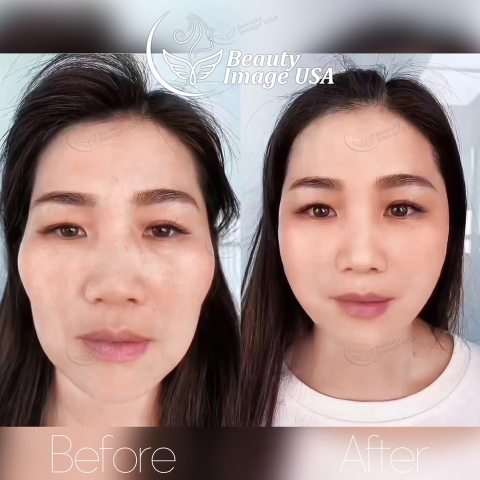 Album căng chỉ