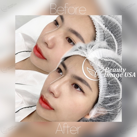 Album căng chỉ